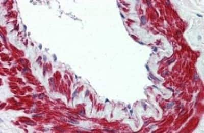 Immunohistochemistry-Paraffin: TRPM8 Antibody [NBP3-14506] - TRPM8 antibody IHC of human lung, vessel. Immunohistochemistry of formalin-fixed, paraffin-embedded tissue after heat-induced antigen retrieval.